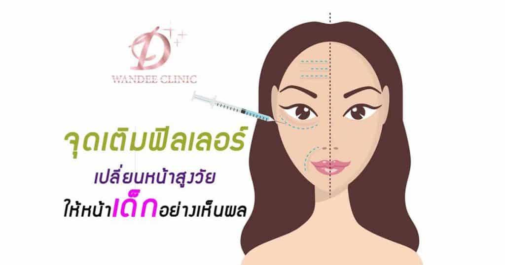 ฉีดฟิลเลอร์ขอนแก่น