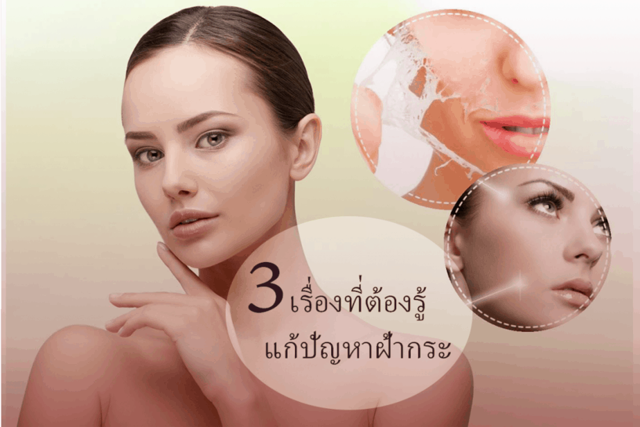 แก้ปัญหาฝ้ากระ