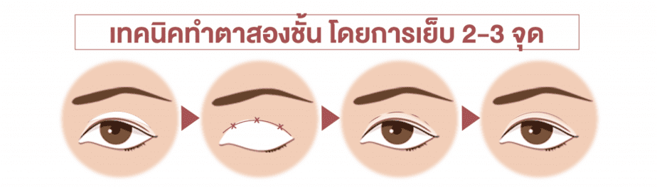 ตาสองชั้นแบบเกาหลี