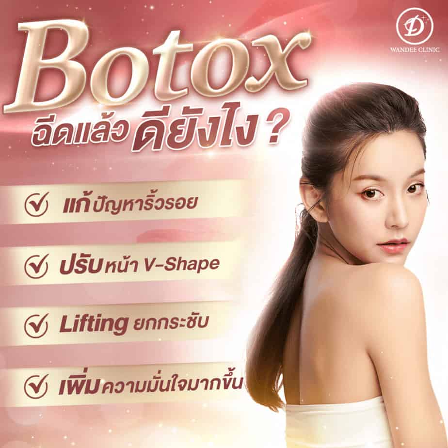 โบท็อกซ์ allergan