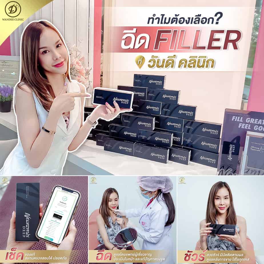 neuramis filler ดีไหม