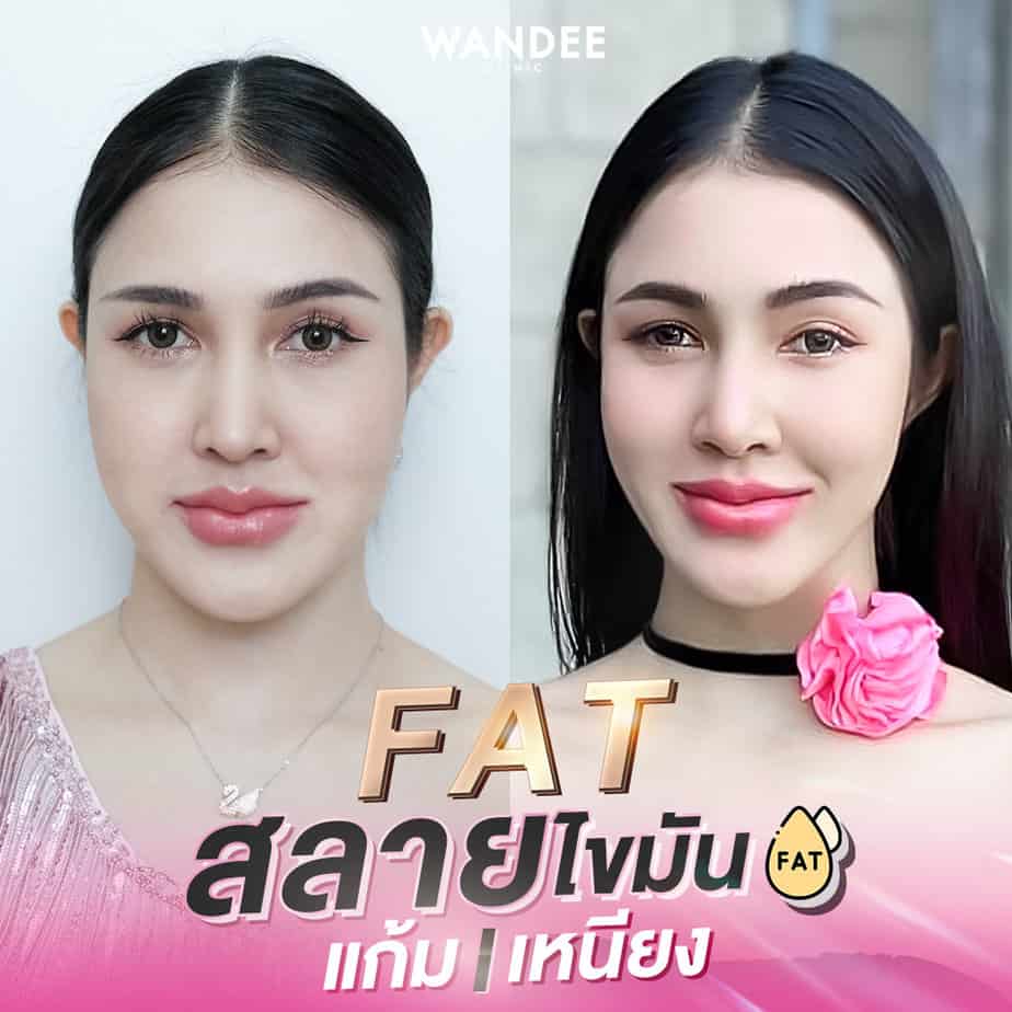 Diamond fat กี่วันเห็นผล