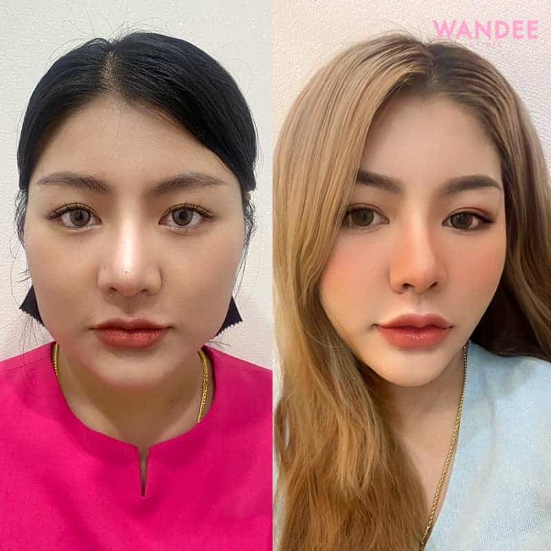 Diamond fat กี่วันเห็นผล