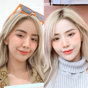 ฟิลเลอร์ปากอยู่ได้นานไหม