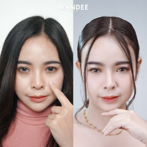 ฟิลเลอร์